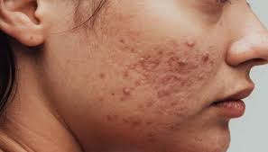Affordable Dermatology Clinics Near Me for Skin Care: A Complete Guide