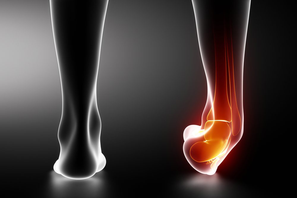 How to Prevent Common Ankle Injuries This Fall