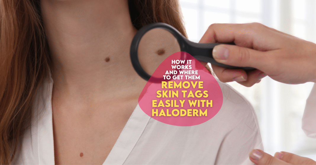 How to Safely Remove Warts
