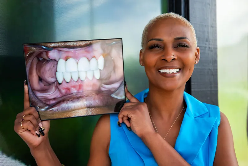 The Role of Dental Implant Specialists in Full Mouth Reconstruction