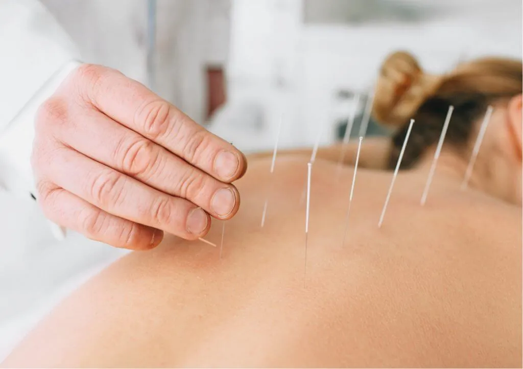 Why Acupuncture is Effective in Managing Digestive Health