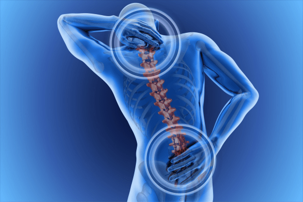 Exploring Prolotherapy for Chronic Back Pain Relief