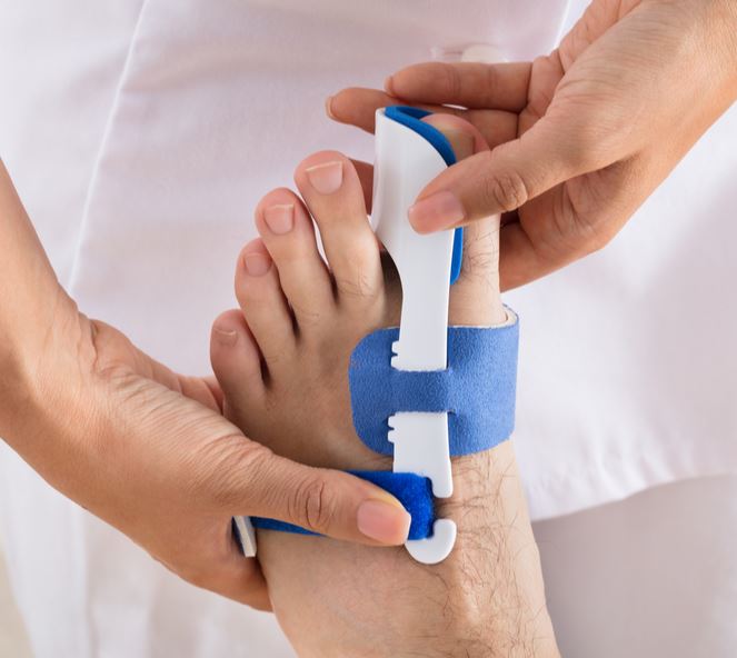 Lifestyle Changes to Alleviate Bunion Pain