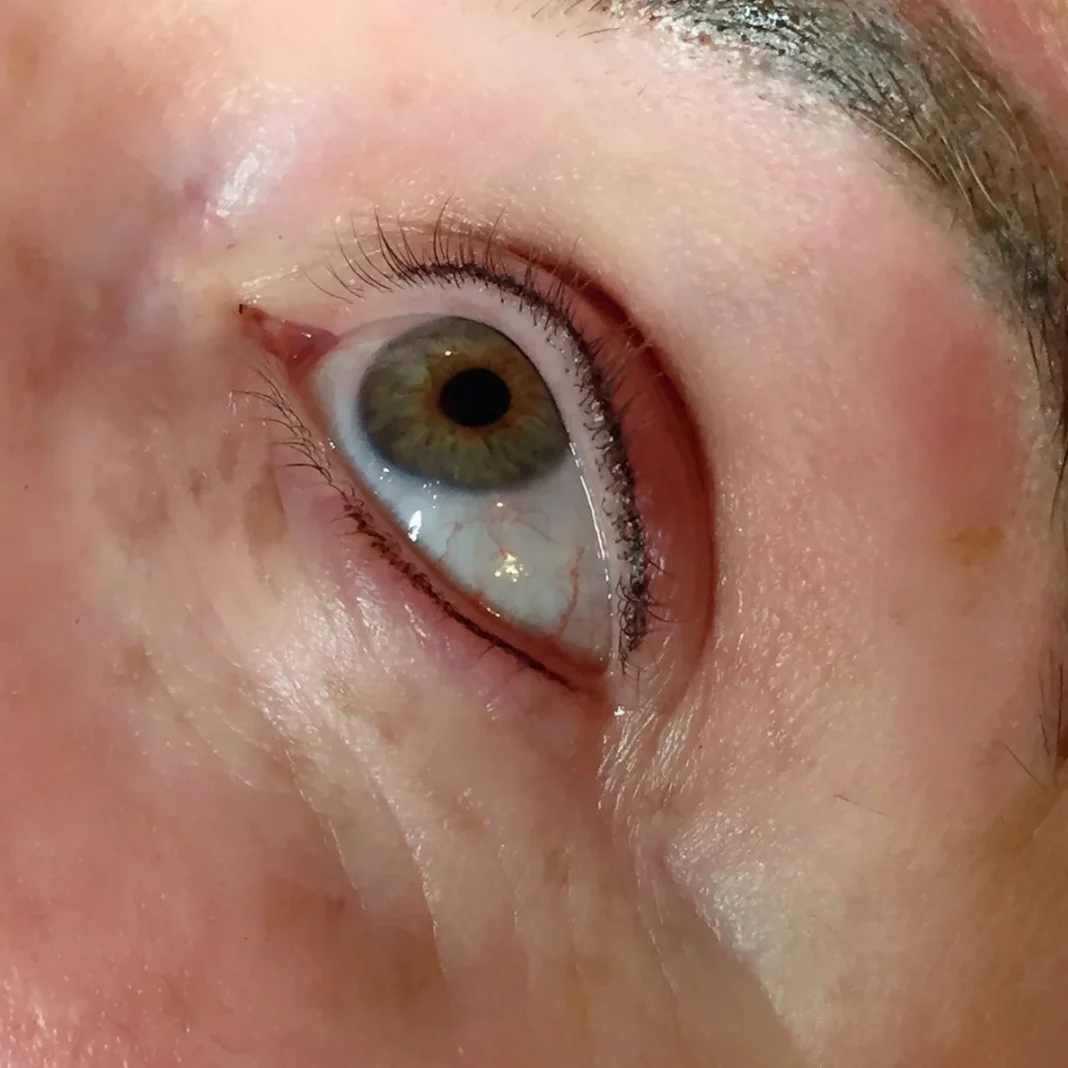 Ophthalmologist Specializations Explained