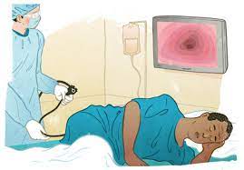 Signs of Complications After Colon Cancer Surgery